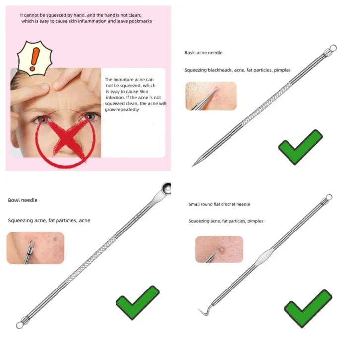 4PCS Blackhead Remover Acne Needle Tools Set Face Cleaning Black Dots Pimple Comedone Extractor Pore Cleaner Skin Care Products - Image 4