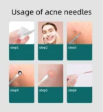 4PCS Blackhead Remover Acne Needle Tools Set Face Cleaning Black Dots Pimple Comedone Extractor Pore Cleaner Skin Care Products - Image 6