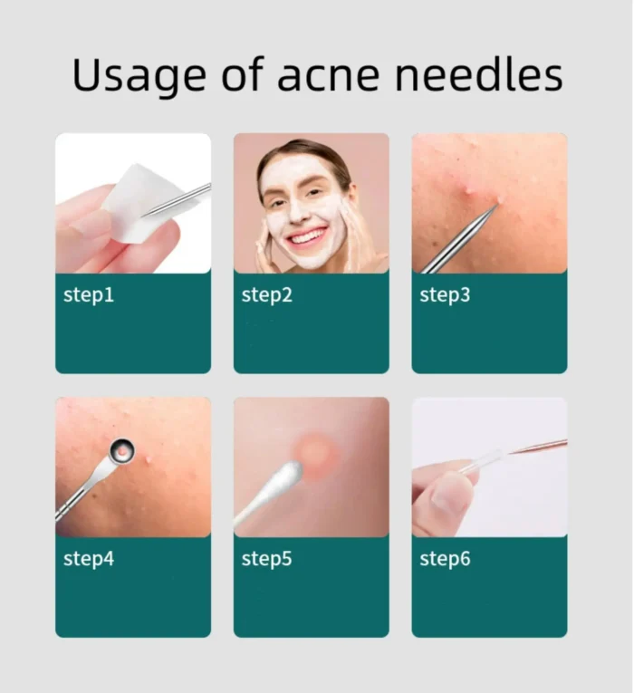 4PCS Blackhead Remover Acne Needle Tools Set Face Cleaning Black Dots Pimple Comedone Extractor Pore Cleaner Skin Care Products - Image 6